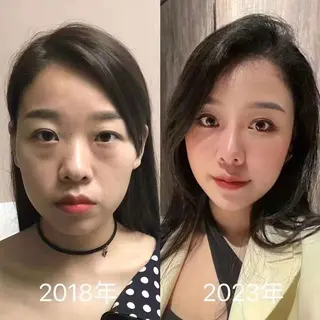 ネイル aliaハーブ水光店 エステティシャン募集のエステ・リラクイメージ