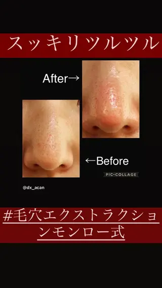 o3remedy所属・宇野澤 彩加のエステ・リラクイメージ