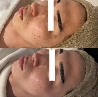 中目黒ハーブピーリン グ🌿ララピールのエステ・リラクイメージ