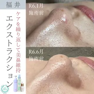 毛穴肌質ケアサロン Yourmeユアミーのエステ・リラクイメージ