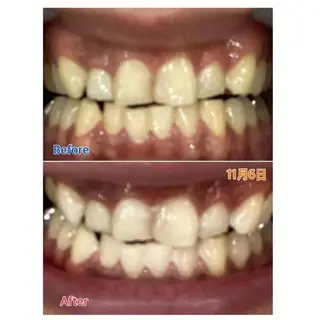 M渋谷 ホワイトニングのエステ・リラクイメージ