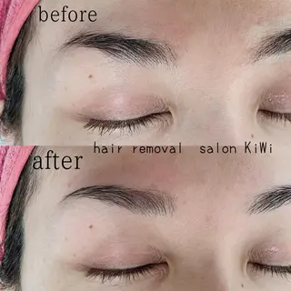 アイブロウ 脱毛サロン KiWiのエステ・リラクイメージ