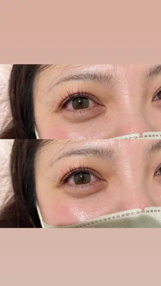 マツエク・マツパ 麻生 雪菜のマツエク・マツパデザイン