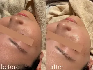 Erika komorebi_のエステ・リラクイメージ