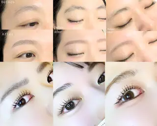 アイブロウ 【医療提携エステ】 ルミナス北浦和のその他イメージ