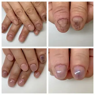 ネイル ネイルサロン アリュームのネイルデザイン
