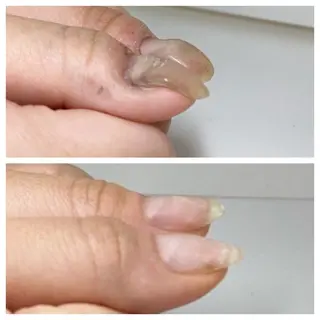 ネイル ネイルサロン アリュームのネイルデザイン