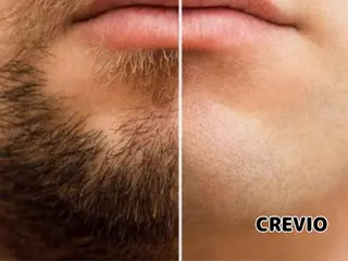 ブラジリアンワックス＆光脱毛サロン   CREVIO所属・脱毛サロン CREVIOのエステ・リラクイメージ