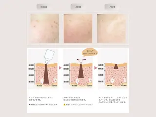 milky 【ミルキー】のエステ・リラクイメージ