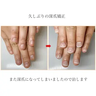ネイル ネイルサロン アリュームのネイルデザイン