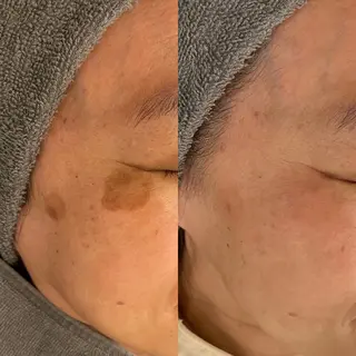 シミケア専門店 &Moreのエステ・リラクイメージ