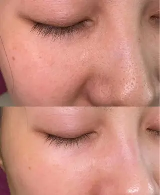 マツエク・マツパ aliaハーブ水光店 エステティシャン募集のエステ・リラクイメージ