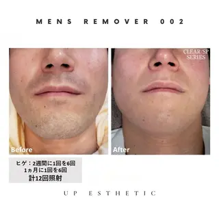 メンズ 韓国肌管理 ウプエステティックのエステ・リラクイメージ