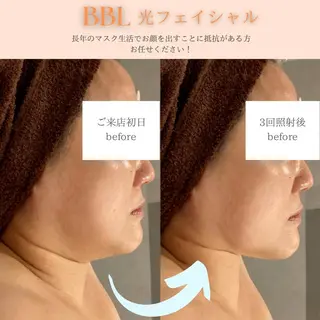Dahlia Beautyのマツエク・マツパデザイン
