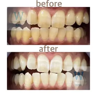 ホワイトニング ショップ船橋2号店のエステ・リラクイメージ