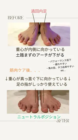 足トラブル専門 ニコルル金沢のエステ・リラクイメージ