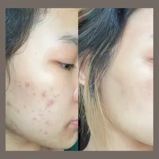 愛維美水光美肌専門店所属・愛維美水光美肌専門店 メンズレディースokのエステ・リラクイメージ