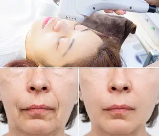 顔脱毛＆毛穴＆ニキビ 優良№1♪ヒロコ♪のエステ・リラクイメージ