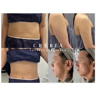 心斎橋🤍堀江.小顔 ハーブ.痩身クレビアのエステ・リラクイメージ