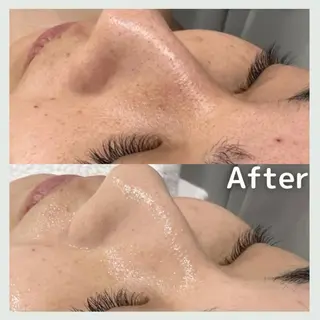 Florence  〜salon de nurse所属・Florence めぐみのエステ・リラクイメージ