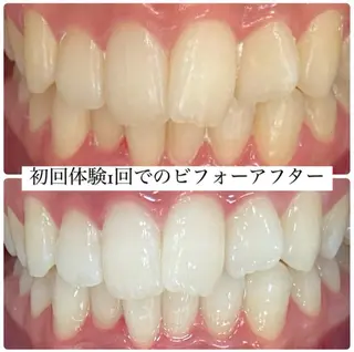ホワイトニングルーム 横浜店のその他イメージ