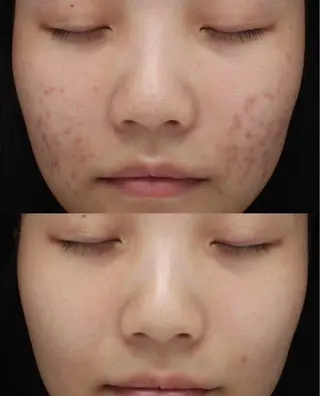 ネイル aliaハーブ水光店 エステティシャン募集のエステ・リラクイメージ