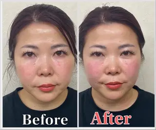 整体 LALUZ中目黒のその他イメージ