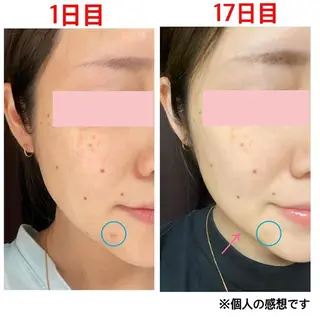 tominaga ryokoのヘアスタイル