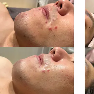 Relaxation SalonARONAのエステ・リラクイメージ