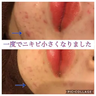 セミロング カラー パーマ ヘアアレンジ メンズ キッズ ネイル マツエク・マツパ 金の糸脱毛 産毛ケア専門のエステ・リラクイメージ