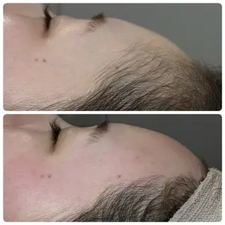 A"-HILU （アーヒル)のエステ・リラクイメージ