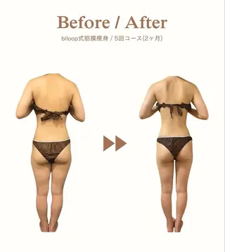 biloop所属・《本気痩せ×疲労改善 》  BILOOPのエステ・リラクイメージ