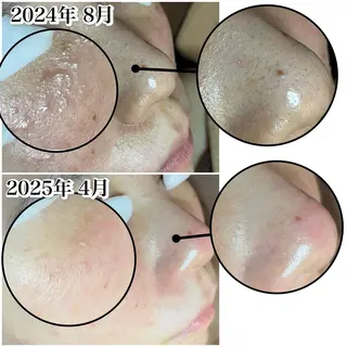 ツヤ肌・美肌サロン (エコル　フル)のエステ・リラクイメージ