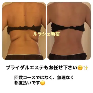 【痩身】インドエステ ＆筋膜リリースのエステ・リラクイメージ