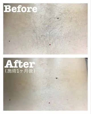 エステサロン Cozy[コージー]のエステ・リラクイメージ