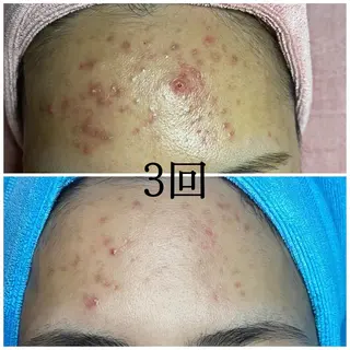 MiA Beautyのエステ・リラクイメージ