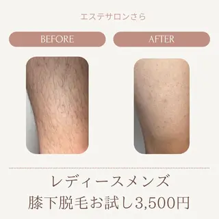 エステサロン さらのエステ・リラクイメージ