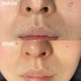 a laise 斉藤（表参道）のエステ・リラクイメージ