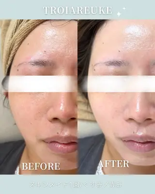 abbellina×uno所属・Anna / 出雲・肌質改善のエステ・リラクイメージ