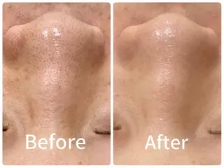 産後/ツヤ肌/子連れ /保育士在籍サロンのエステ・リラクイメージ