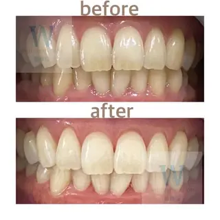 ホワイトニング ショップ船橋２号店のエステ・リラクイメージ