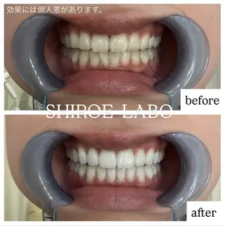 【歯のホワイトニング専門店】シロエラボ梅田店所属・シロエラボ 梅田店のその他イメージ