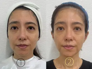 e-Reju イリュージュのネイルデザイン