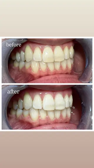 セルフホワイトニング Shineeのエステ・リラクイメージ