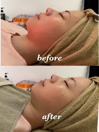 メンズ 腸活サポート みなみののエステ・リラクイメージ