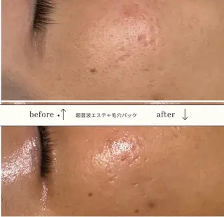 skinLabo所属・saya Mのエステ・リラクイメージ