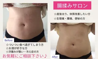 子宮矯正/腸揉み/ シュガーリング脱毛のエステ・リラクイメージ