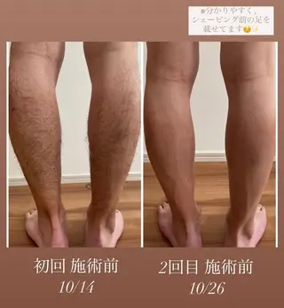 エステサロン Mi-mi.iのエステ・リラクイメージ