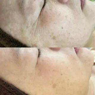 BeautySalo nCielChibaのエステ・リラクイメージ