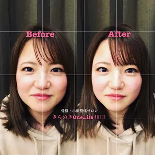 きらめきワンライフ Yumaのエステ・リラクイメージ